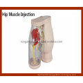 High Level Hip Muscle Injection Comparison Simulator